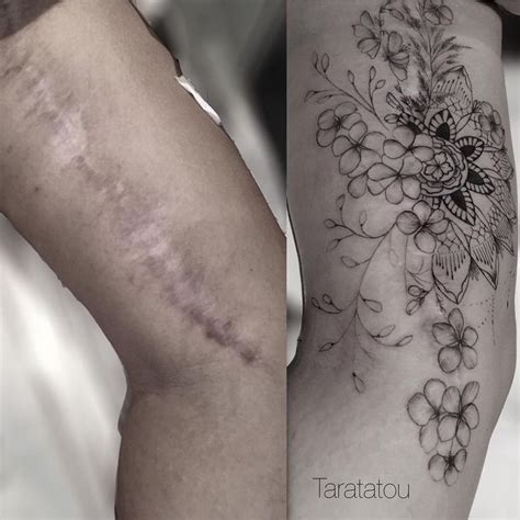 Tatouage Recouvrement Cicatrice Avant Bras